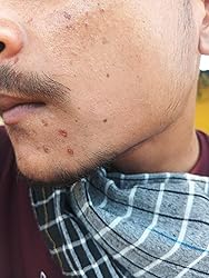 Skin Feels So Fresh