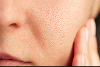 Helps tighten pores for smoother skin