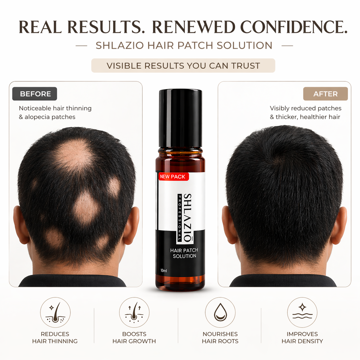 Hair Patch Roll-On for Alopecia | Natural Hair Regrowth Treatment
