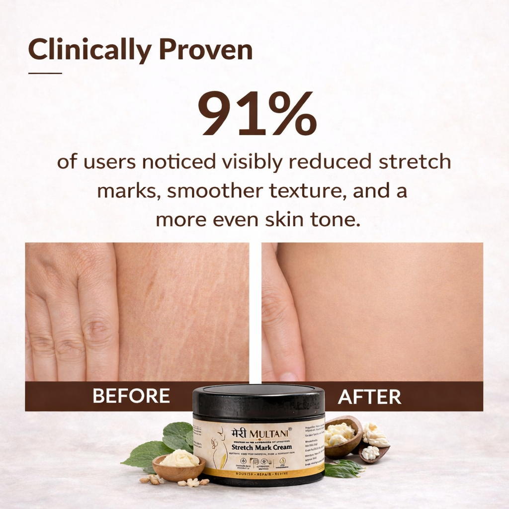 Merimultani Stretch Mark Cream